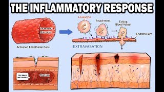 THE INFLAMMATORY RESPONSE [upl. by Bayless]