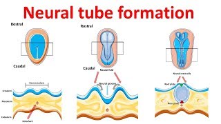 neural tube formation  Embryology  Neurulation [upl. by Nageam]