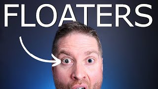 Eye FLOATERS Top 5 Questions Answered About Visual Floaters [upl. by Saloma]