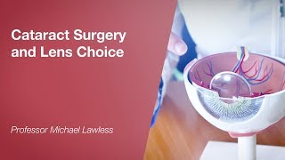 Cataract Surgery and Lens Choice [upl. by Ybbil942]