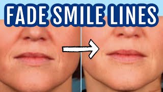 12 ways to fade smile lines nasolabial folds Dr Dray [upl. by Urbannai]