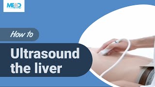 How to ultrasound the liver [upl. by Notgnirra107]