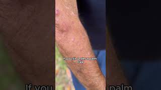 Mango Worm Parasite How do you remove them shorts florida mangoworms [upl. by Gittle888]