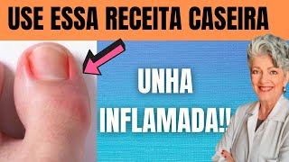 REMÉDIO CASEIRO Para UNHA INFLAMADA [upl. by Bellanca952]