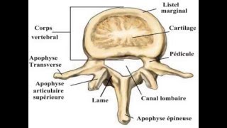 traumatologie Fractures du rachis Dorso – lombaire [upl. by Rebna]