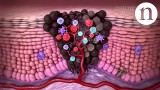 Tumour immunology and immunotherapy [upl. by Worsham833]