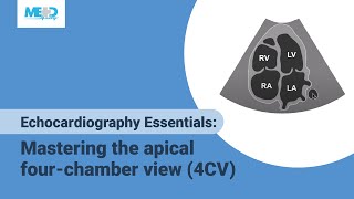 Echocardiography Essentials Mastering the apical fourchamber view 4CV [upl. by Ruckman186]