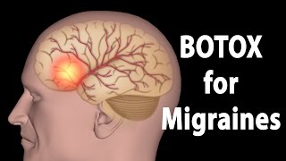 Treatment for Trigeminal Neuralgia UCSF Neurosurgery [upl. by Ettezzus661]