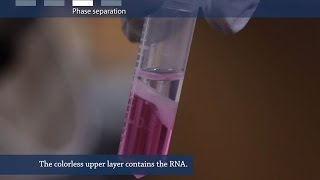 How to isolate RNA from tissue or cells [upl. by Ahsiral]