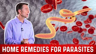 Best Home Remedies for Parasites – Dr Berg [upl. by Jalbert34]