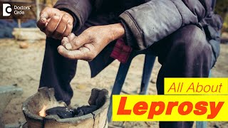 5 Symptoms of Leprosy  Types of Leprosy World Leprosy Day 2021DrRashmi Ravindra Doctors Circle [upl. by Sinnod]