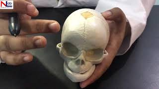 Fetal Skull in Hindi हिंदी Practical Explanation  Nursing Lecture [upl. by Weinhardt]