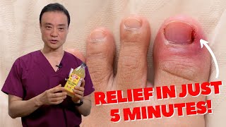 6 HOME REMEDIES To Treat A PAINFUL Ingrown Nail  Dr Kim [upl. by Gretal352]