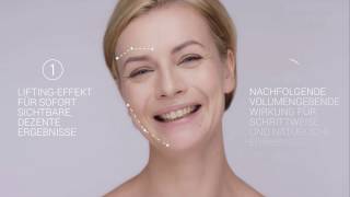 Fadenlifting – Sanftes Facelifting in der Sophienklinik mit Fäden von Silhouette™ [upl. by Onaled]