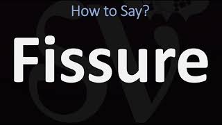 How to Pronounce Fissure CORRECTLY [upl. by Ahsito401]