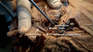 Parotid Gland II  Structures within [upl. by Alaikim]