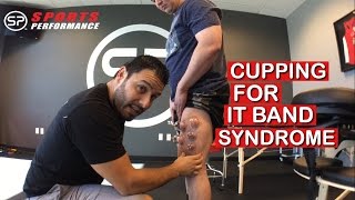 IT Band Syndrome Cupping Therapy  Knee Pain Treatment  Sports Performance Physical Therapy [upl. by Callista778]