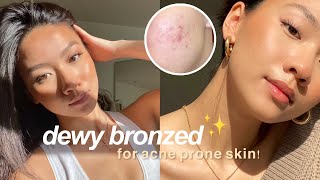 My Quick Natural Glow Makeup acneprone skin dark acne scars  Colleen Ho [upl. by Irakuy]