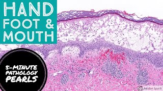 Disease Damage A 2001 Report on Foot and Mouth Disease in Britain [upl. by Sternlight]