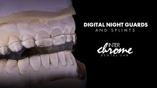 Digital Night Guard and Splint Workflow [upl. by Eussoj101]