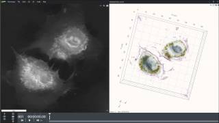 HUVEC cells with gold nanoparticles [upl. by Polad]