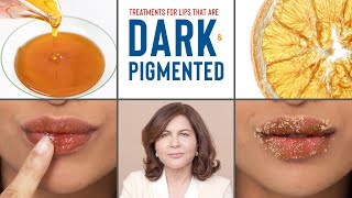 How To Treat DARK PIGMENTED Lips  Dermatologists Advice [upl. by Lihp]