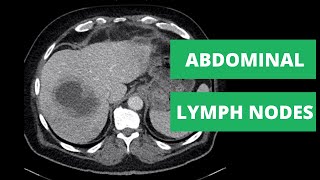 Abdominal CT Lymph Node Stations  How to read a CT [upl. by Chemash]