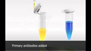 Fluorescence Linked Imminosorbent Assay [upl. by O'Doneven401]