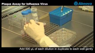 Plaque Assay for Influenza Virus [upl. by Ahsikrats]