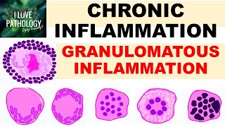 What is a granuloma [upl. by Susanna]