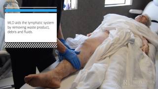 Manual Lymphatic Drainage MLD PostLipedema Surgery [upl. by Kerril]