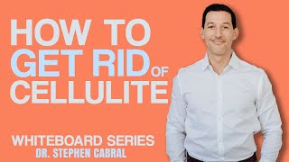 21 Days to REMOVE CELLULITE  Do These 3 Things for QUICK Results  Dr Stephen Cabral [upl. by Pinsky]