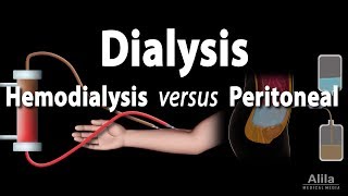 Renal Replacement Therapy Hemodialysis vs Peritoneal Dialysis Animation [upl. by Yelrahs890]