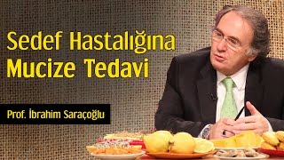 Sedef Hastalığına Mucize Tedavi  Prof İbrahim Saraçoğlu [upl. by Eselahc694]