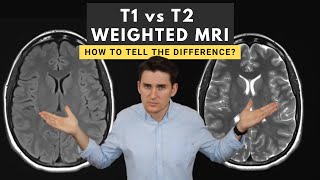 T1 vs T2 weighted MRI images How to tell the difference [upl. by Ennaxxor193]