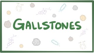 Gallstones cholelithiasis [upl. by Gipsy721]