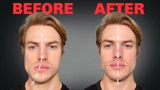 How to Fix Asymmetrical Jaw amp Face FOREVER [upl. by La Verne]