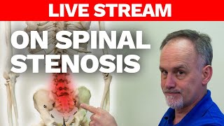 Myths and Facts about Spinal Stenosis [upl. by Meurer211]