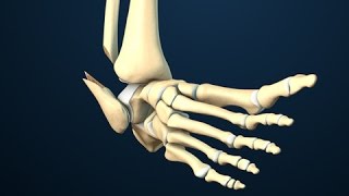 Ankle Fracture Surgery [upl. by Anoek]