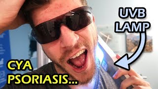 Psoriasis UVB Light Treatment From Home  Vlog 3 [upl. by Ahsiram221]