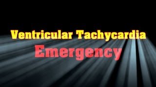 Symptoms and Causes of Ventricular Tachycardia [upl. by Nemzaj161]