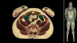 Anatomy internal organs human body [upl. by Rann]