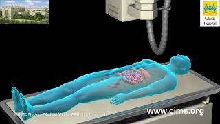 Barium Enema Hindi – CIMS Hospital [upl. by Ellerehs]