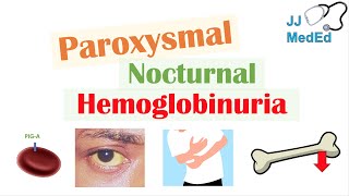 Paroxysmal Nocturnal Hemoglobinuria PNH  Causes amp Pathogenesis Symptoms Diagnosis amp Treatment [upl. by Ahens200]