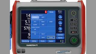 What is Mechanical Ventilation  Ventilators EXPLAINED [upl. by Ozner]