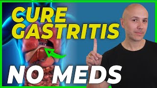 My Gastritis Experience  How I got diagnosed  symptoms [upl. by Hamlet989]