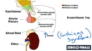 Methotrexate  Adverse Effects and Monitoring [upl. by Odlonra]