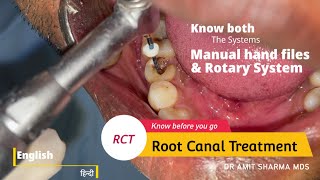 How Root canal treatment  RCT is done  Know both Manual and Rotary system [upl. by Pinette]