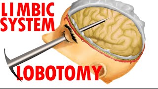 Limbic System Anatomy  Lobotomy And Human Emotions [upl. by Ahtekal]