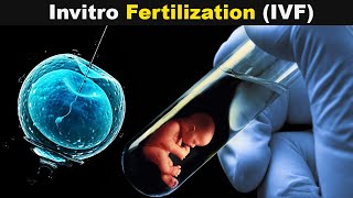 How Test Tube Babies Are produced  Invitro Fertilization UrduHindi [upl. by Yanel]